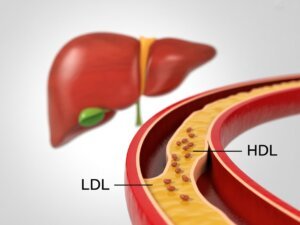lower cholesterol naturally by improving LDL and HDL balance.